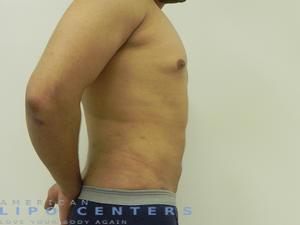 americanlipocenters_123.jpg